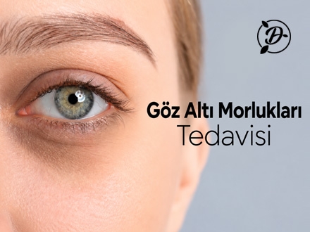 Göz Altı Morlukları Tedavisi Adana